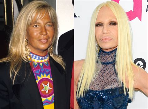 donatella versace before and after pictures|current pictures of donatella versace.